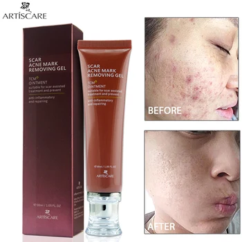 

Ginseng Extract Cream Scar Removal Facial Blackhead Acne Treatment Bleaching Ceam 30ml HB88