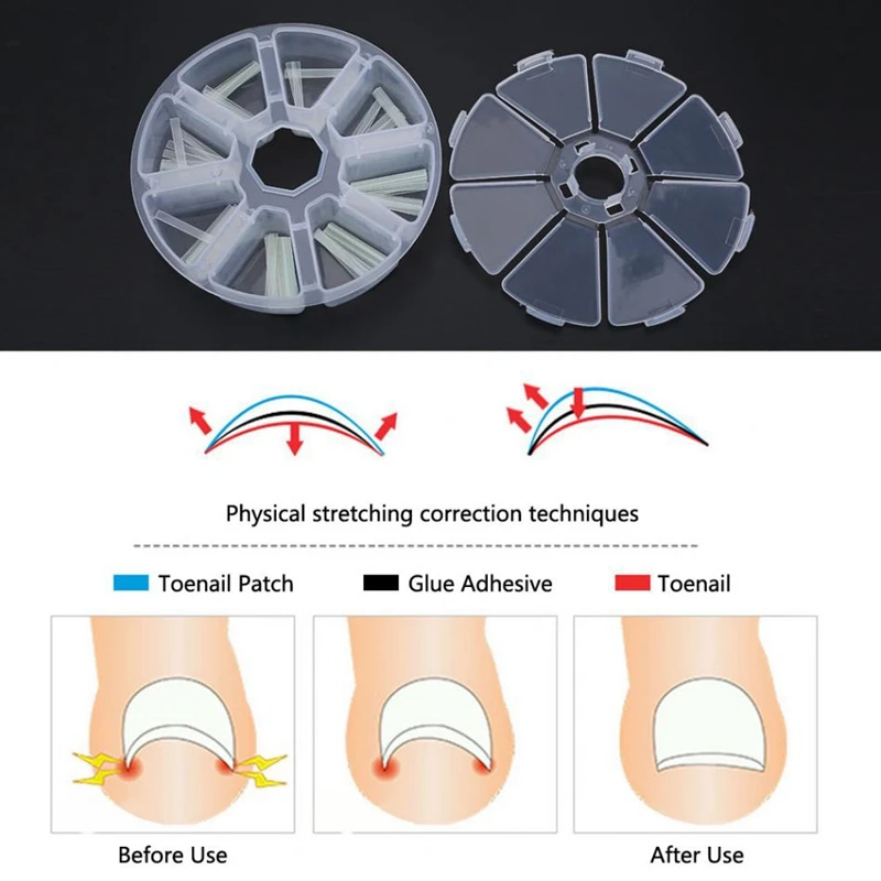 120 шт./кор. встроенный Toenail Стикеры-корректоры внутренний рост педикюр лечебный патч держатель Поддержка педикюра Средний уход T