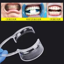 10 Pcs Opener Dental mouth C-type opener Disposable mouth flaring  Opening device