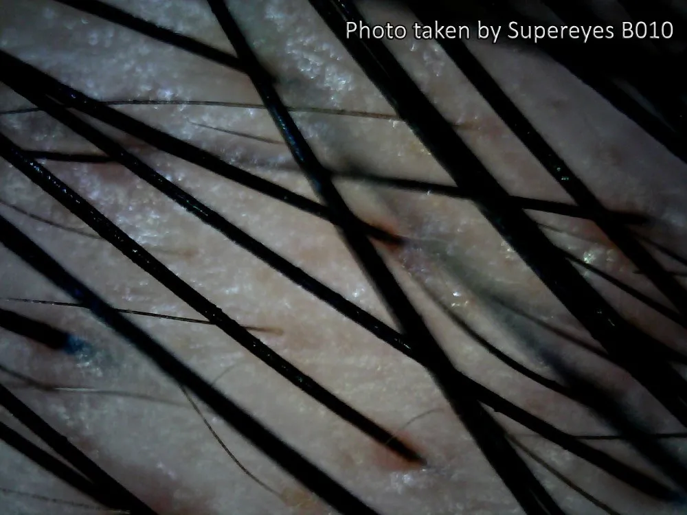 Spereyes B010-S 300X2 MP USB Microscópio Digital