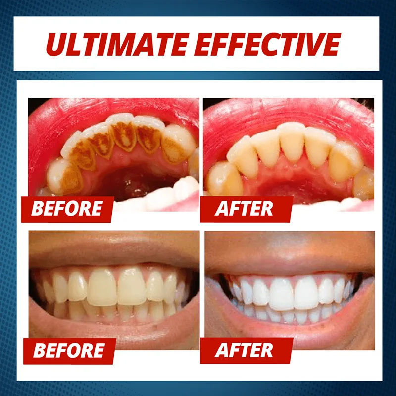 Intensive Stain Removal Whitening Toothpaste Teeth Whitening Cleaning Oral Care Magical Baking Soda Toothpaste Drop Shipping