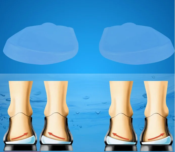 стельки при варусной деформации. ортопедические стельки при вальгусе стоп у детей. ортопедические стельки варус вальгус. вальгусная деформация стопы ортопедические стельки. стельки супинатор вальгус.