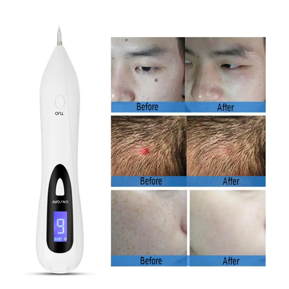 

USB Rechargeable Mole Spot Freckle Tattoo Removal Pen LCD Adjustable Electronic Dot Removing Pen Skin Care Tool