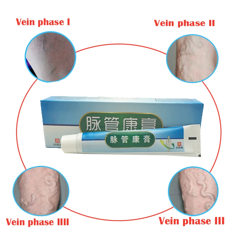 2/3/4/5/10 шт. расширения вен медицинский препарат против варикозного расшрения вен лечение крем анти ноги васкулита флебит травяной продукт dropshoping
