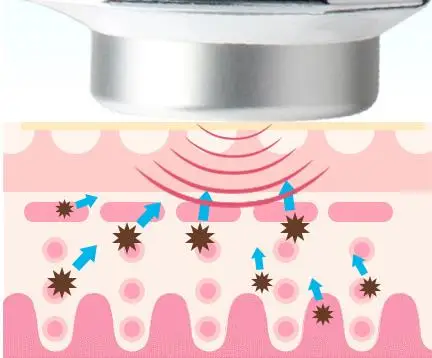 1 МГц ультразвуковая машина для ухода за кожей лица, ультразвуковая регенерация морщин для устранения акне пигментации