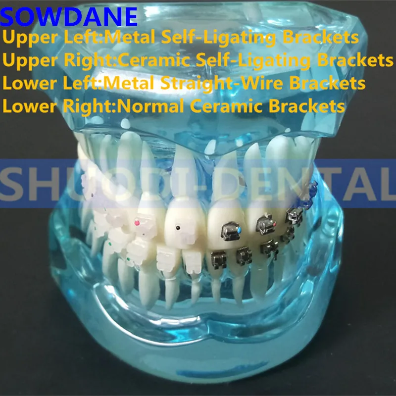 

Dental Communication Toth Model Teeth Model 4 kinds Brackets with Ceramic Self Ligating Bracket Metal Self Ligating Bracket