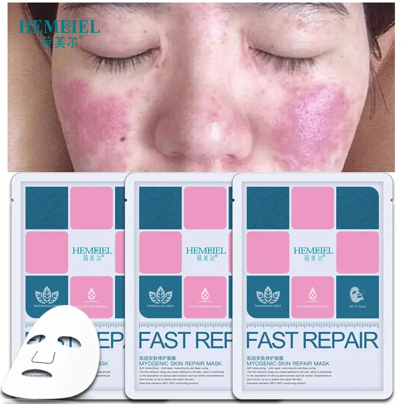 

HEMEIEL Sensitive Repair Mask Anti Acne Oil Control Moisturizing Mask Face Whitening Anti Redness Anti Allergy Treatment Mask