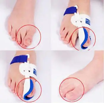 

Big Toe Straightener Bunion Hallux Valgus Corrector Night Splint Foot Care tool