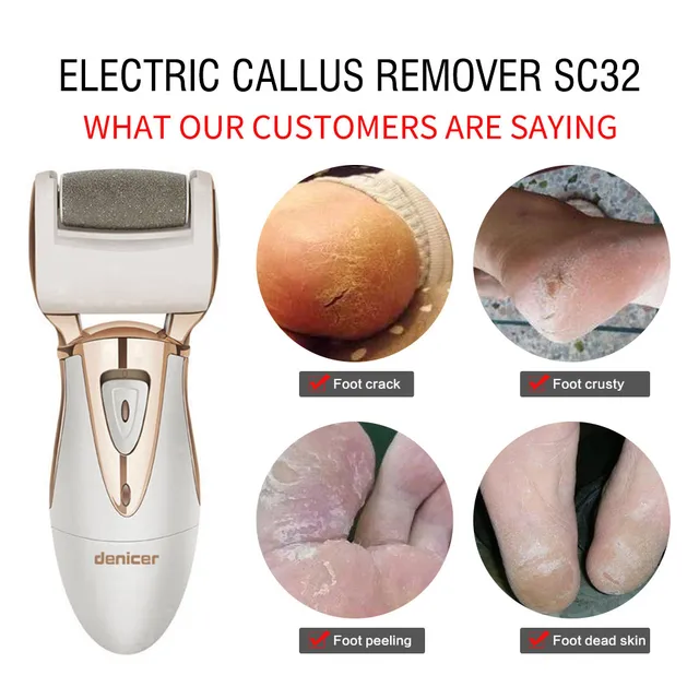 Electric Foot Care Pedicure Product Callus Remover Rechargeable Pedicura File Machine for Peel Dead Skin Removal Feet Care Tools