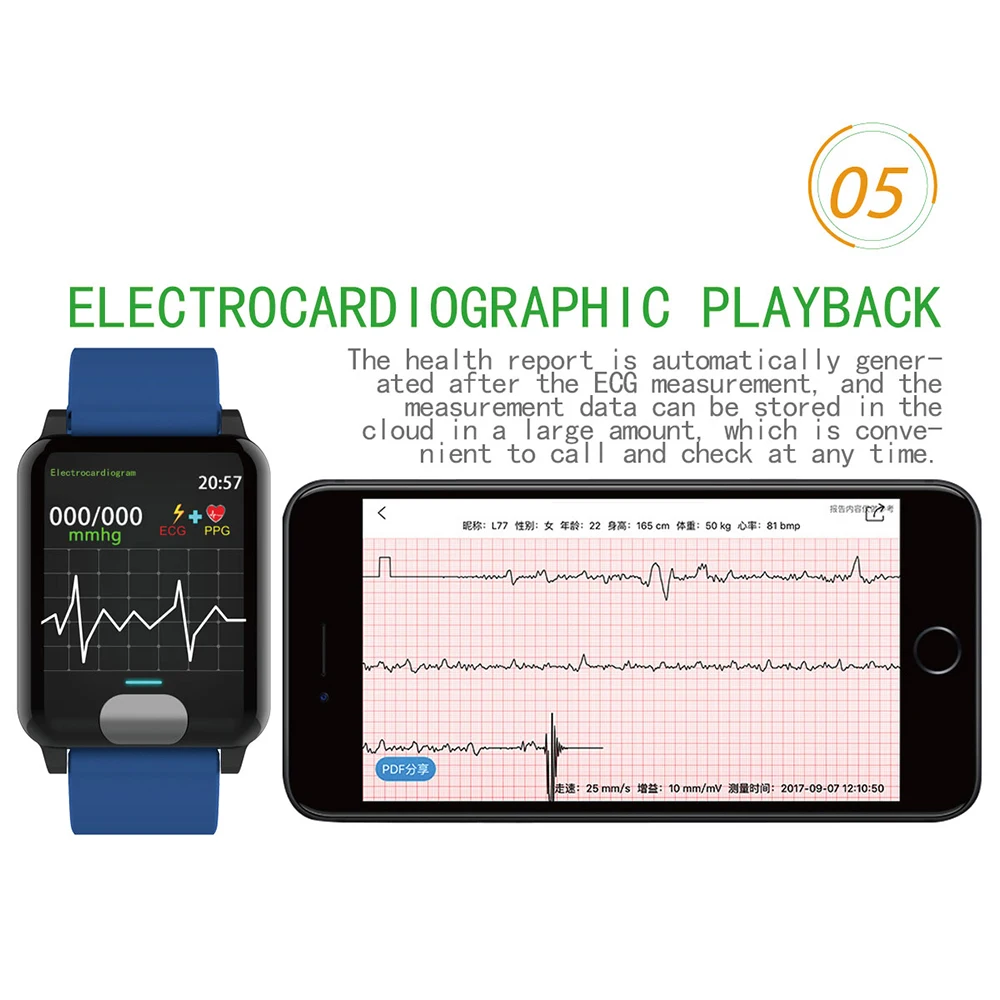лучшие часы с экг. экг на эппл вотч 6. лучшие часы с экг. смарт-часы new ecg + ppg. Apple watch ecg.