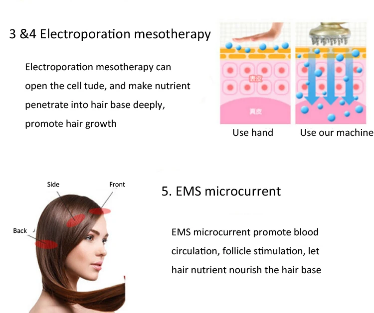 Мини РФ Электропорация мезотерапия РФ EMS роста волос лазера вибрации питательный Настой питают кожу Релаксация массажер гребень
