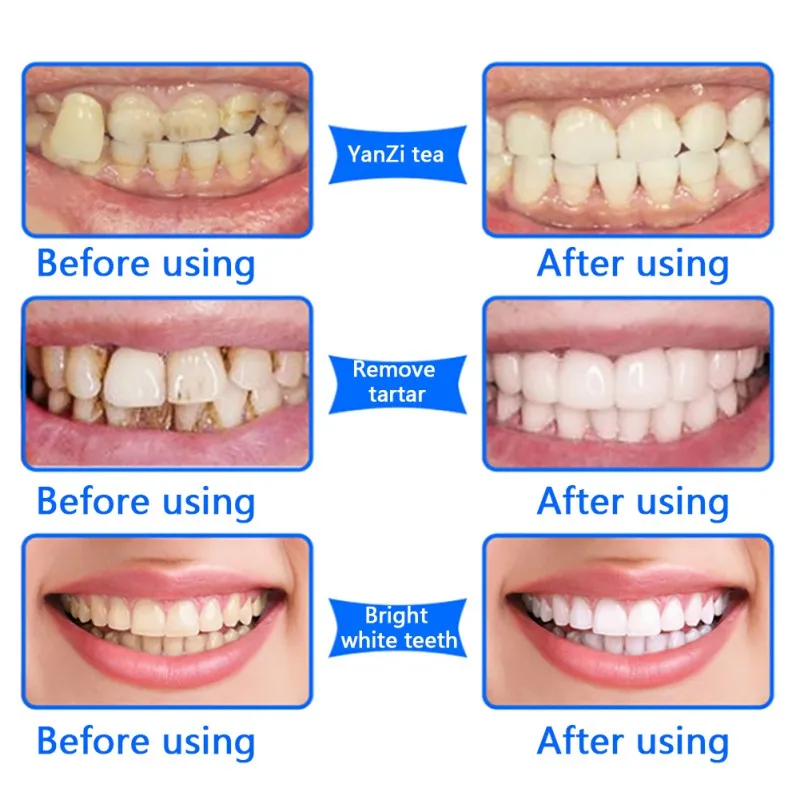 

Teeth Brighten Oral Hygiene Cleaning Tools Stains Remover Gentle Natural Plant Tooth Whitening Powder Oral Hygiene H7