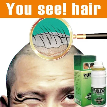 

60ml Powerful pilatory hair growth treatment original Regain Hair Loss Treatment Extra Strong Fast Growth Liquid For Women Men