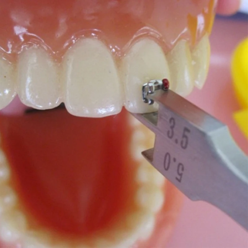 Стоматологическая Скоба датчик размещения стоматологический Орто бар Тип Скоба двойной кронштейн локатор расположение Калибр 2,0 мм-6,0 мм