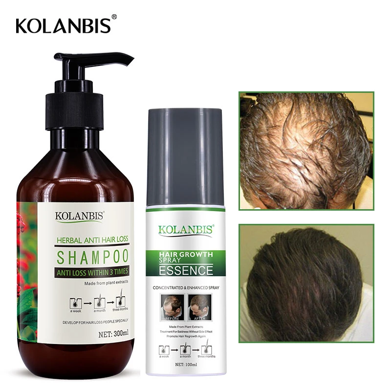 Kit de tratamiento para la pérdida de cabello para hombres, Serum para crecimiento graso, champú para la pérdida de cabello, producto espesante la calvicie, restauración de Alopecia Anti caída|Productos anticaída