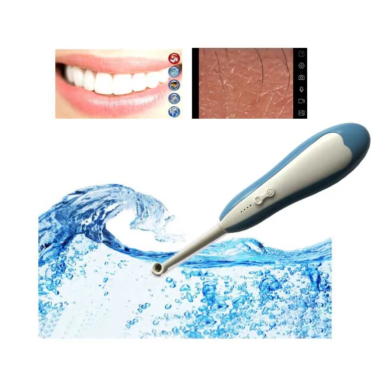 1-Oral endoscope