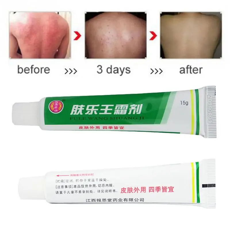 

1PC Skin Psoriasis Cream Dermatitis Eczematoid Eczema Ointment Treatment Psoriasis Cream 15g