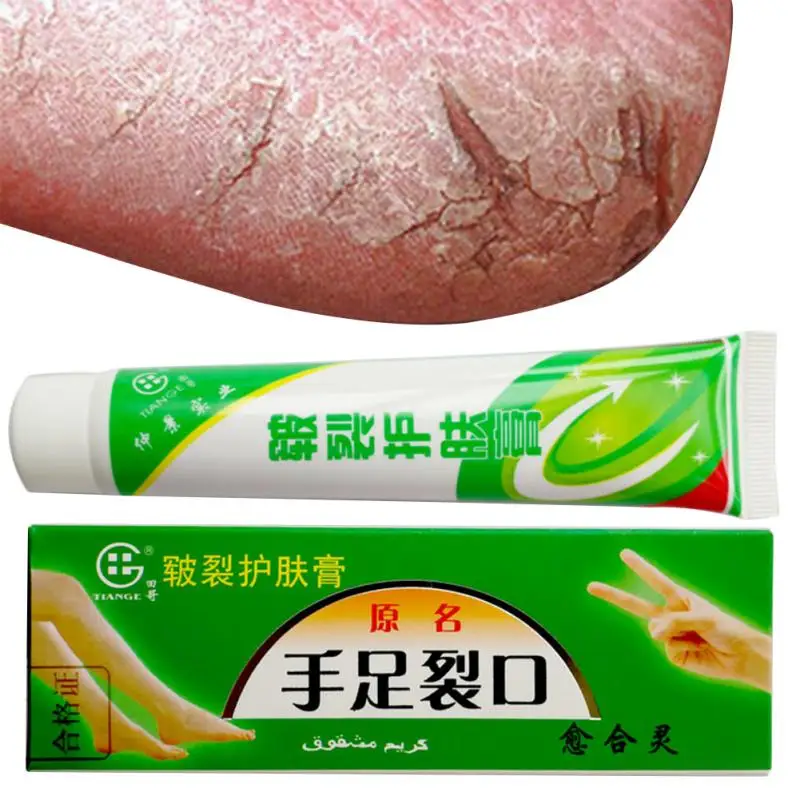 Пятка обветренный пилинг ремонт китайской лекарственной мази крем для рук ног крем от трещин анти сухой обветренный крем лечение сухой кожи