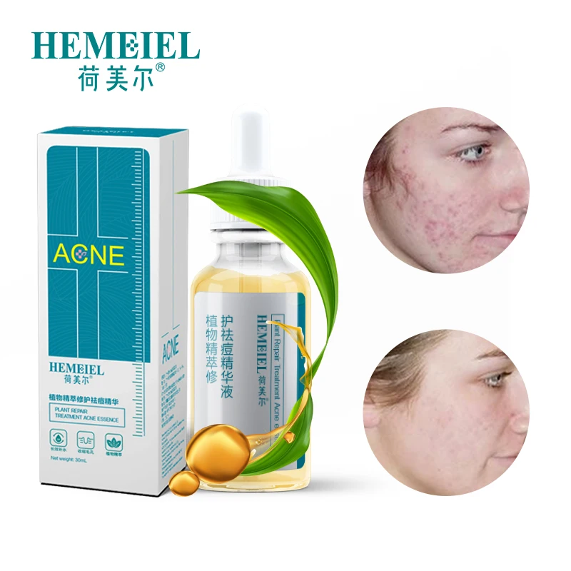 HEMEIEL Natural Plant Anti Acne Serum Moisturizing Face Serum Skin Care