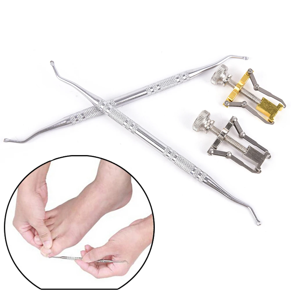 Средство для ухода за вросшими ногтями для пальцев ног средство для восстановления ногтей из нержавеющей стали для педикюра