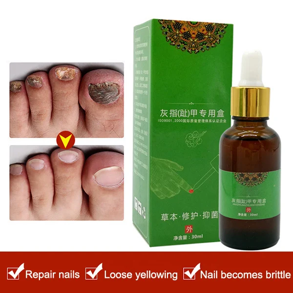 

High Quality Foot Nail Toe Remove Fungus Liquid Essence Repair Moisturizing Cleaning Care Treatment