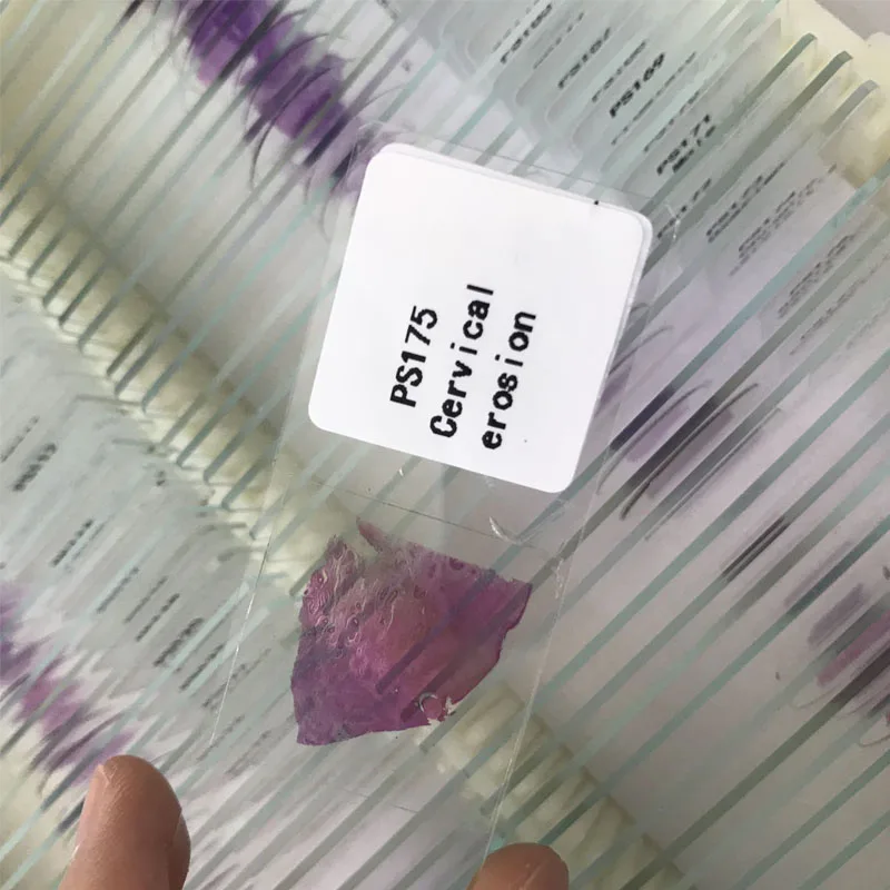 

200pcs Human Pathology prepared slides
