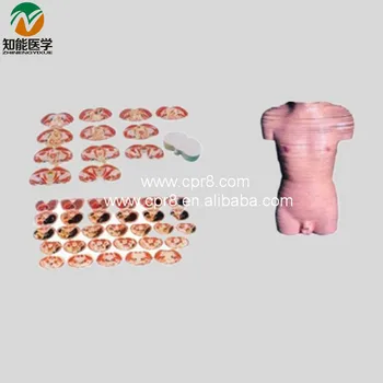 

Human Body Model (Male Transverse Section Model ) BIX-A1070 WBW381