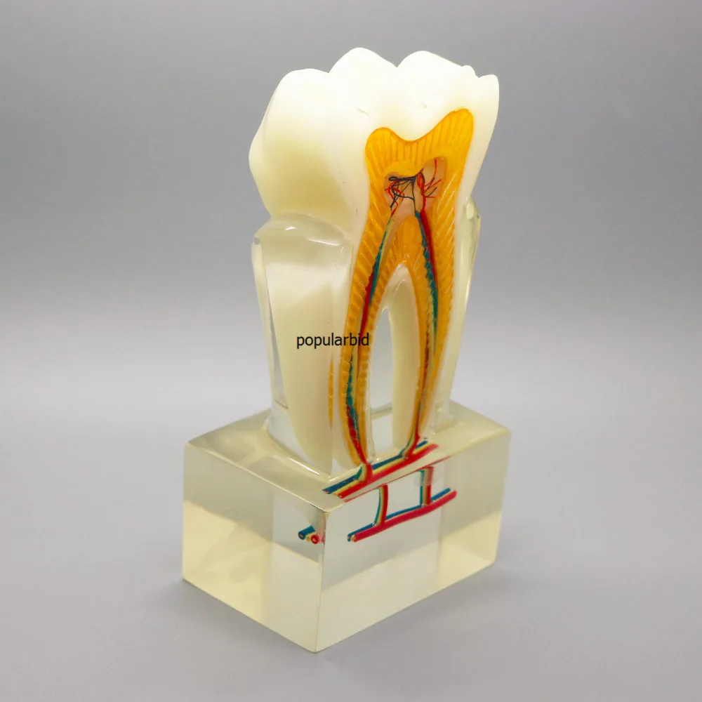 Ортодонтическая модель 6:1 зубы нерв анатомическая разборка демонстрация стоматолога эндодонтика обучение с ясным основанием