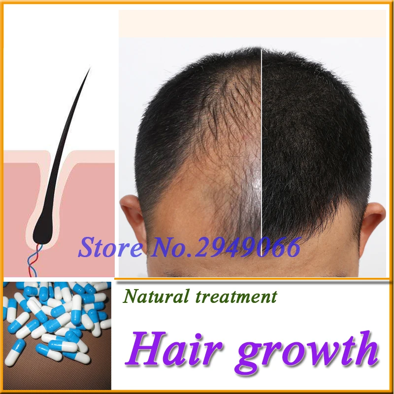 Chinese Medicine Herbs Hair Growth Treatment Hair Care For Women