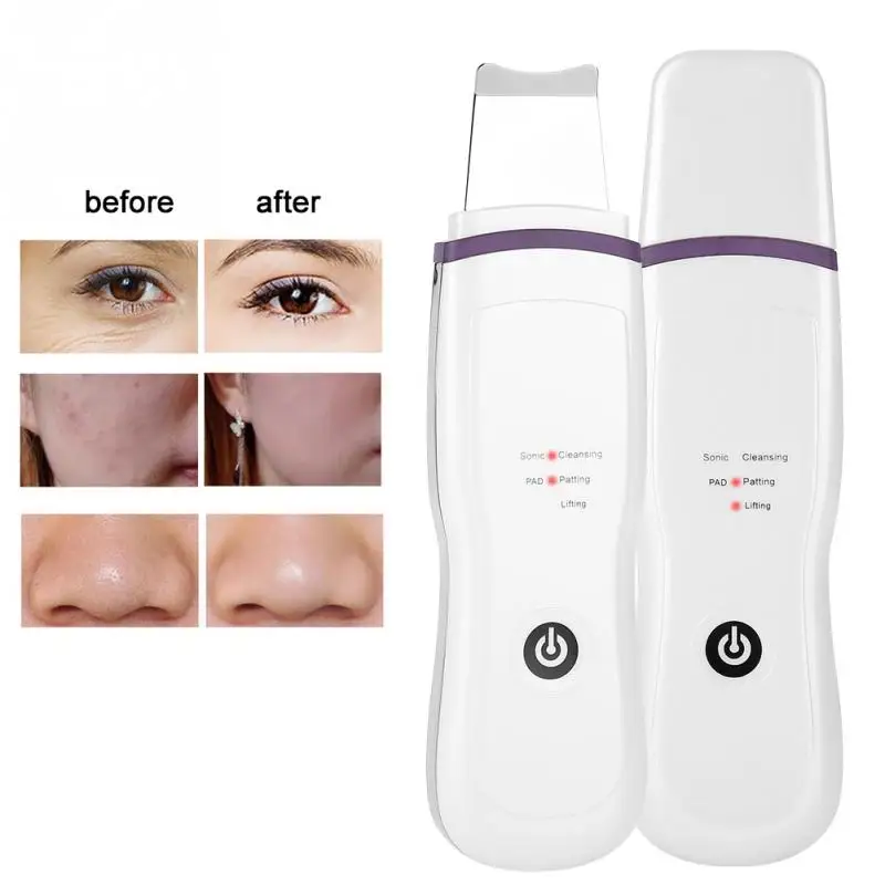 

Ultrasonic Face Ion Skin Scrubber Cleaner Peeling Vibration Blackhead Removal Exfoliating Pore Cleaner Tools