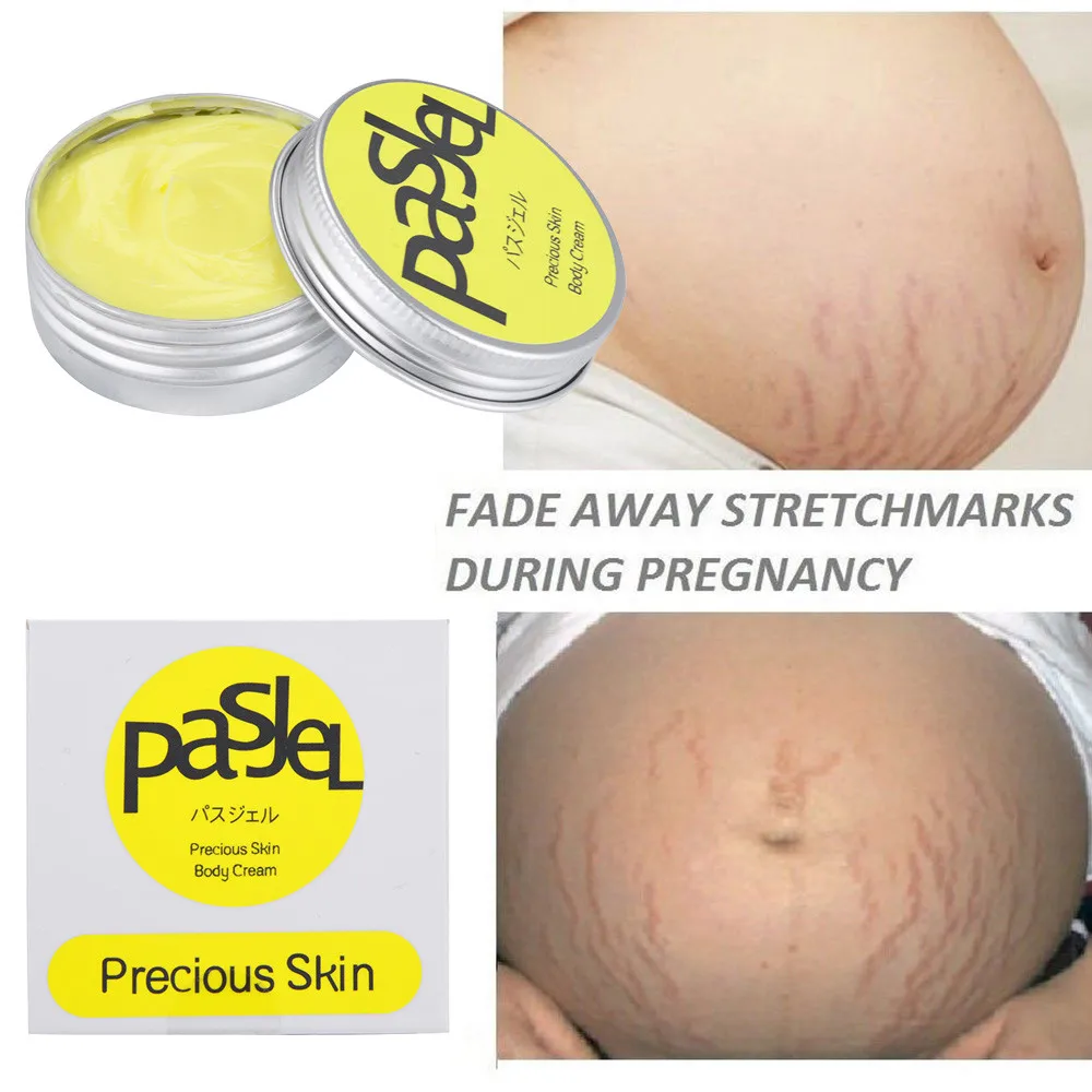 striae out cream