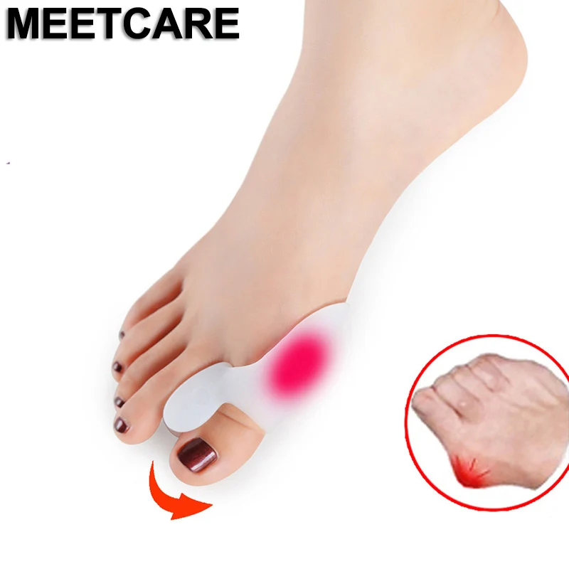 

Women Hallux Valgus Orthosis Toe Appliance Silicone Insole Big and Small Toe Separator Foot Care Tool Bunion Corrector Bone