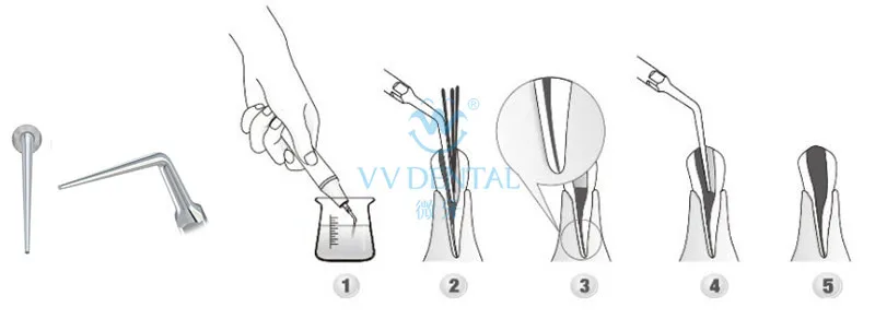 3 шт. ED3 стоматологический Эндо скалер советы для Satelec DTE наконечник скалер