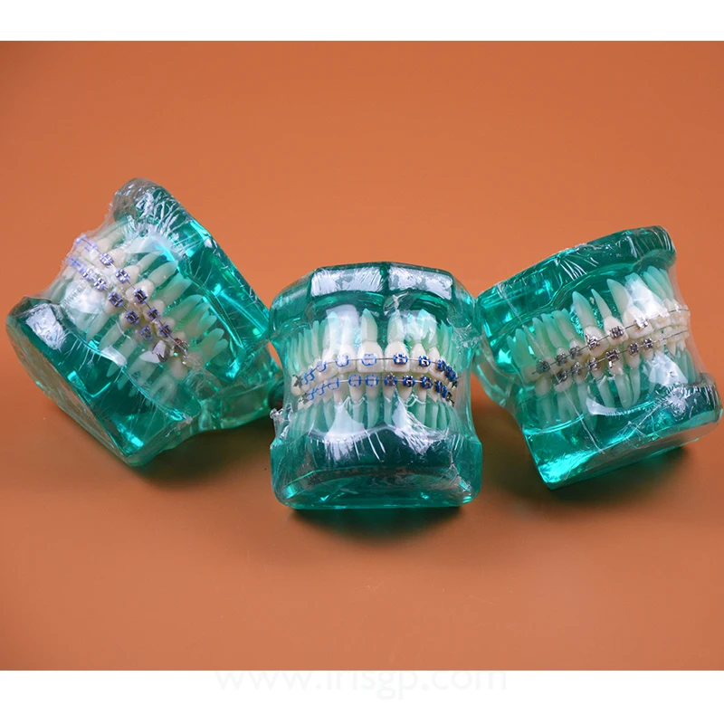 B7-02 Orthodontics Malocclusion Braces Dental Acrylic Teeth Dental Teaching Model Ortho Metal & Cer - 32626113795