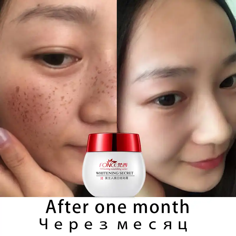 korean skincare dark spots