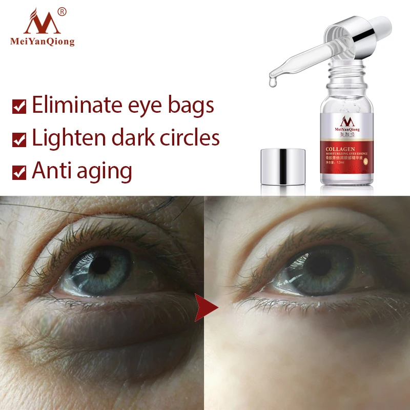 

MeiYanQiong Deep Remove Dark Circle Essence Firming Eye Skin Anti-Wrinkle Essence Remove Fat Eye Bag Serum Eye Skin Care 12ML