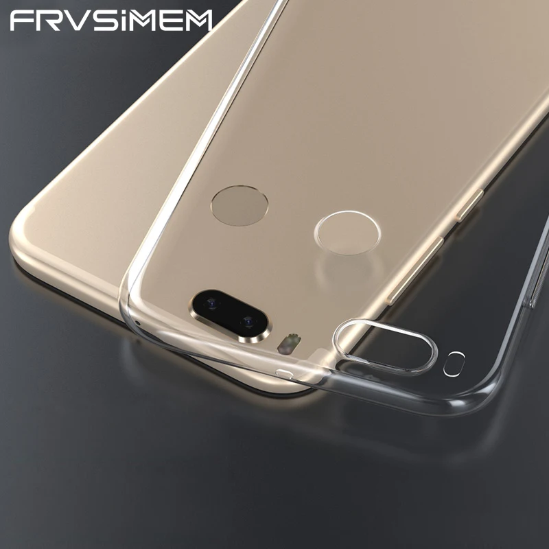 

High Quality Luxury Phone Case for Xiaomi Mi A1 5X MiA1 Redmi 4 Pro 4A Note 5A 4X 4 Global Version Soft Transparent Cover