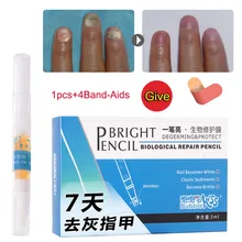 Toenail противогрибковые кремовые ручки для лечения Ногтей грибковая инфекция яркая для спортсменов MSI-19 ног