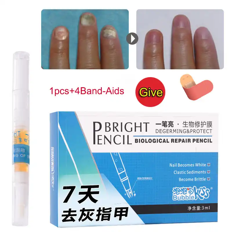 足の爪抗真菌クリームペンネイルトリートメント菌感染用水虫 Msi 19 ネイルトリートメント Aliexpress