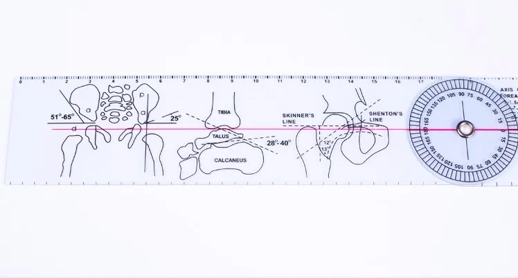 Professional ортопедическая линейка совместное угол измерительная линейка медицинская линейка медицинский измерительный инструмент линейка 21