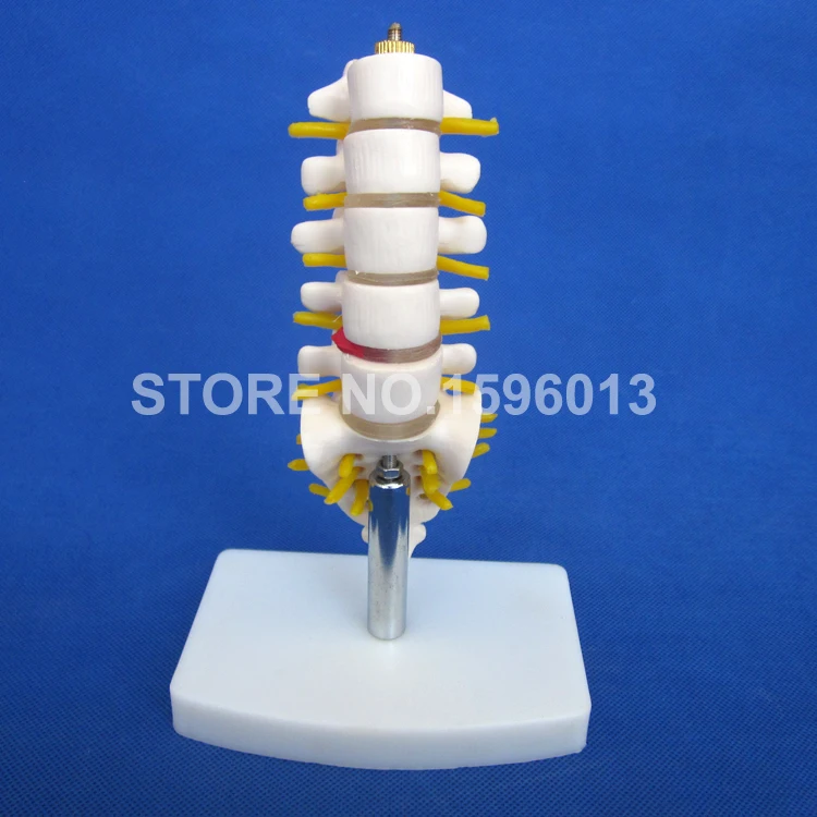 119A lumbar vertebrae (8)