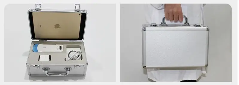 Wireless Probe Type Ultrasound Scanner (5)