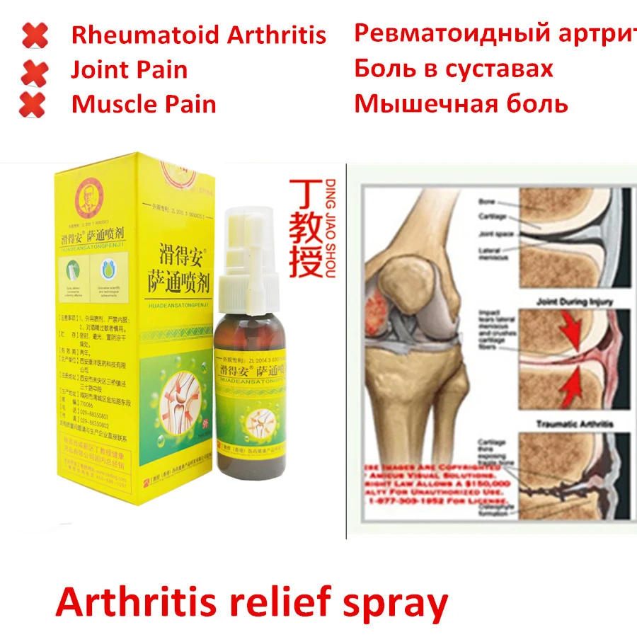 Chinese Herbs Medicine Pain Relief Spray Rapid Relief From Rheumatic