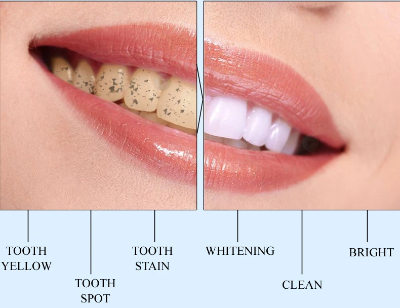 Зубная щетка для отбеливания зубов, очищающая Сыворотка для гигиены полости рта, удаляет зубные пятна, отбеливающие зубы, стоматологические инструменты, зубная паста