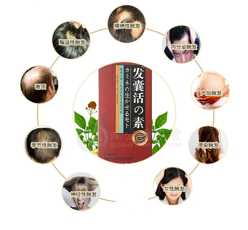 Produtos de Perda de Crescimento do Cabelo Remédios para Perda de Cabelo Tratamento de Perda de Cabelo Ciytan Anti Calvo Alopecia Ervas Naturais 100% 4 Beleza e saúde