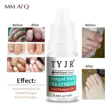 Лучший грибковый Onychomycosis Лечение ногтей от грибка ног ногтей сыворотка ремонт грибок Ног Nail Nourish масло для ногтей удаления кутикулы