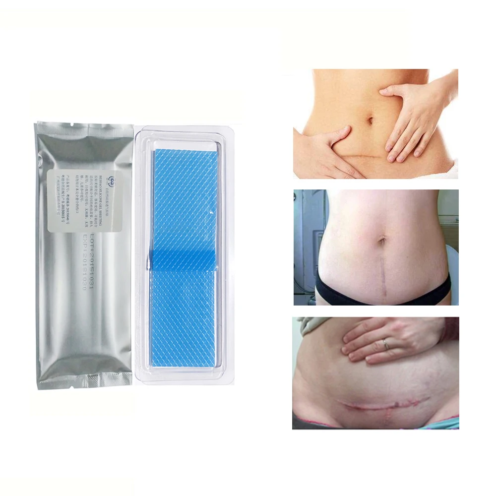 1Pc Silicone Caesarean Section Surgery Removal Scar Sheet Patch Acne Trauma Pregnant postpartum Skin Repair Scar Sheet Patch