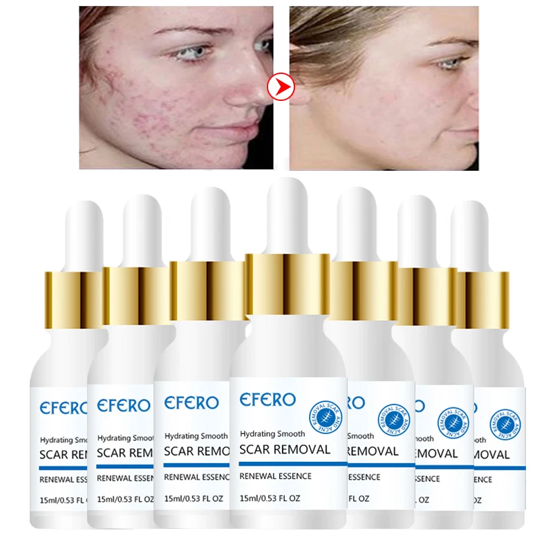 EFERO Acne Сыворотка для лица эссенция гиалуроновой кислоты уход за лицом сужение пор