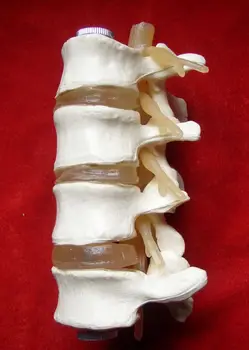 

4 Section Human Lumbar Sketelon Set Lumbar Disc Herniation Demonstration Model Human Lumbar Spinal Model Humans Skeleton Model