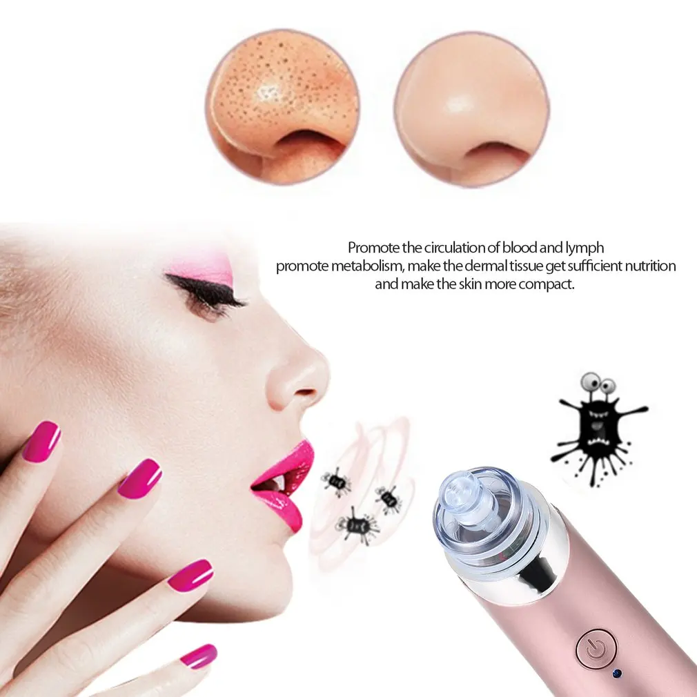 

Face Cleaning Vacuum Negative Pressure Type Acne Pore Cleaning Instrument Beauty Skin Care Specialist with Strong Adsorption